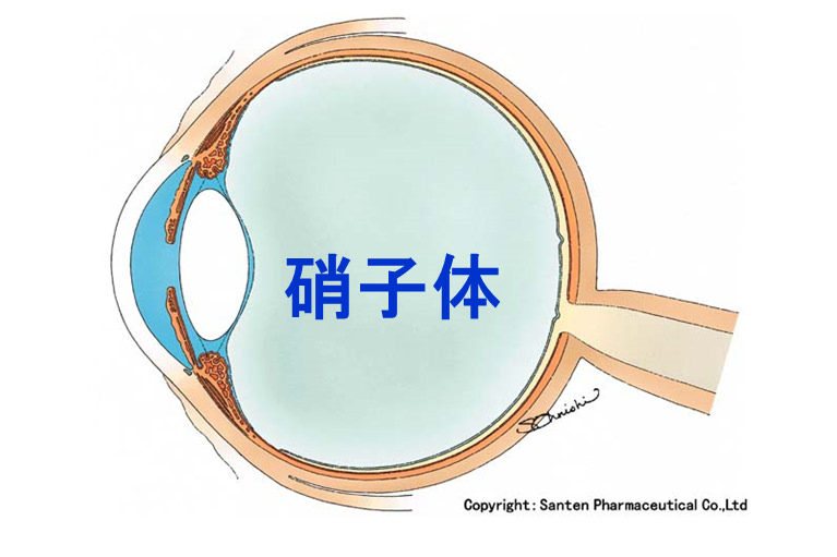 硝子体手術とは